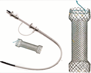 EndoXpert™ Esophageal Metal Stent