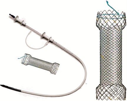 EndoXpert™ Esophageal Metal Stent
