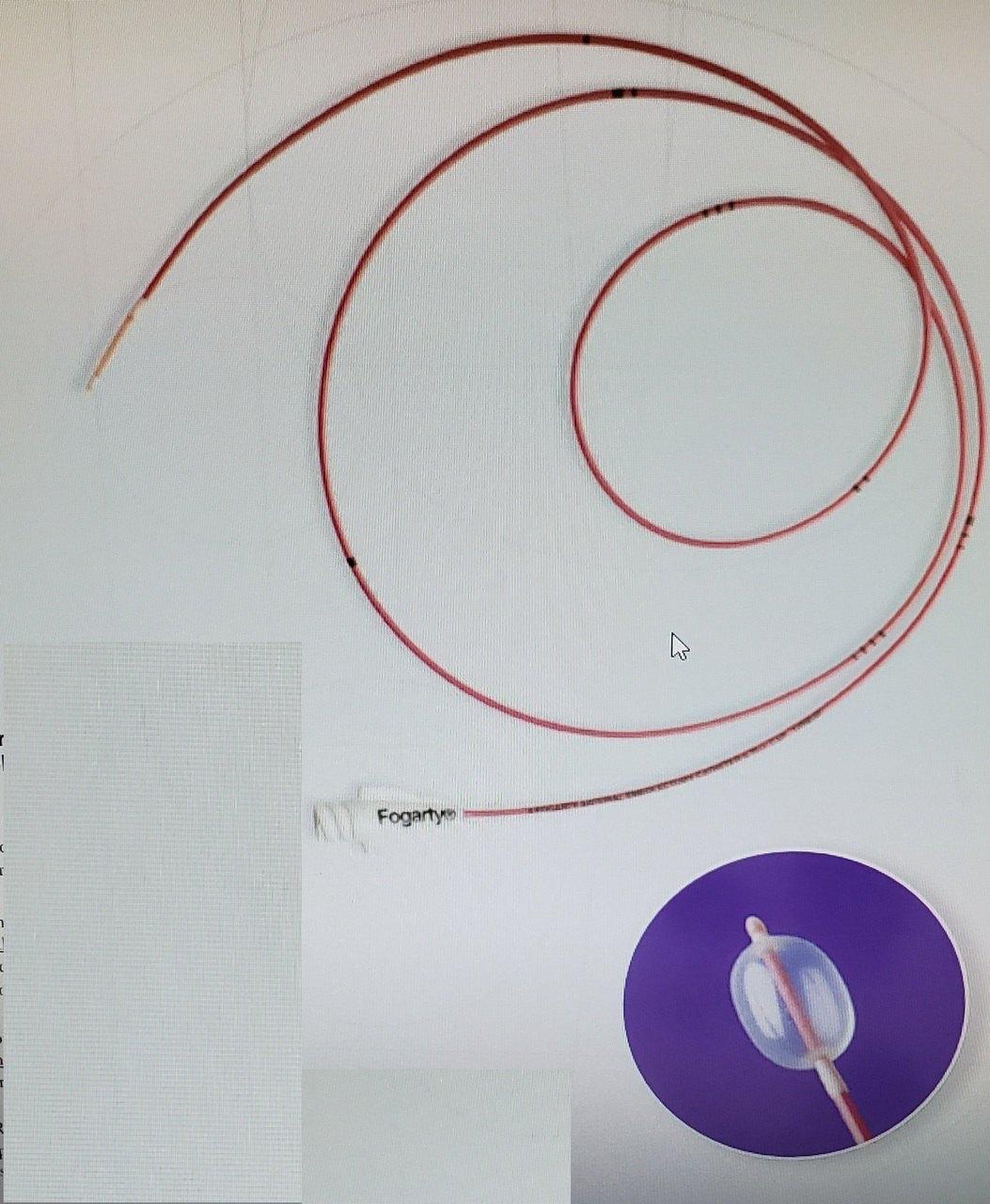 EndoXpert™ Multi-Stage Balloon Dilator